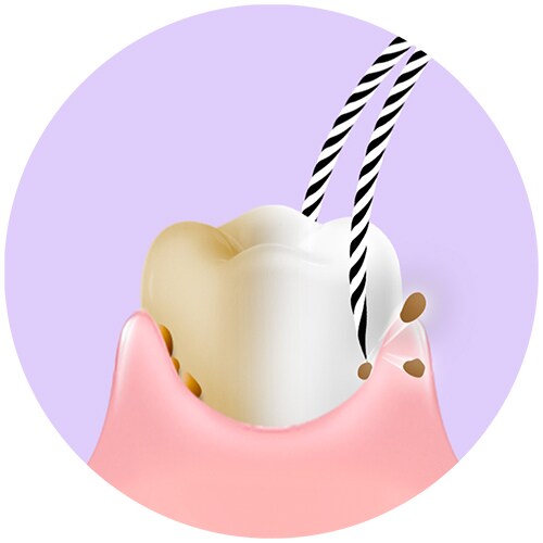 Bulu sikat gigi bergaris membersih sisa makanan dari gigi putih dan kuning